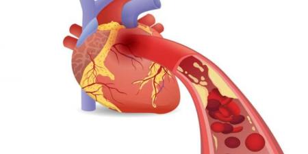 5 أطعمة تضر شرايين القلب: تجنبها - نبض مصر