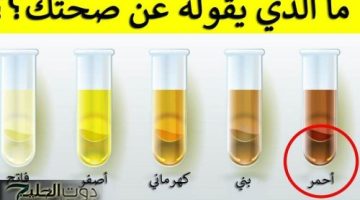 تحذير عاجل.. علامة في لون البول تكشف وجود مشكلة خطيرة في الكلى والكبد