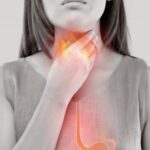 3 خطوات بسيطة لتخفيف حرقة المعدة.. ونصائح طبية للوقاية