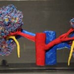 أطعمة تزيد خطر حصى الكلى.. وخبراء يوضحون النظام الغذائي الوقائي