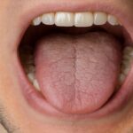 أمراض خطيرة قد يخبئها جفاف الفم.. من السكري إلى اضطرابات المناعة