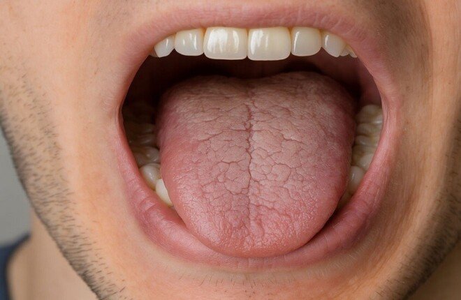 أمراض خطيرة قد يخبئها جفاف الفم.. من السكري إلى اضطرابات المناعة