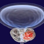 اكتشاف علمي جديد يوضح دور جزيئات الحمض النووي الريبوزي في تطور سرطان البروستاتا