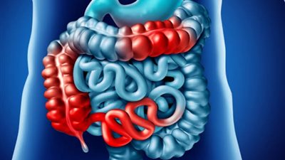 الصيام المتقطع يهزم كرون بنسبة 40% ومفاجأة في الوزن