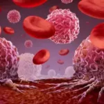 المعهد القومي للأورام في مصر يحذر من علاجات بديلة ترفع خطر الوفاة بمرض السرطان 2.5 مرة