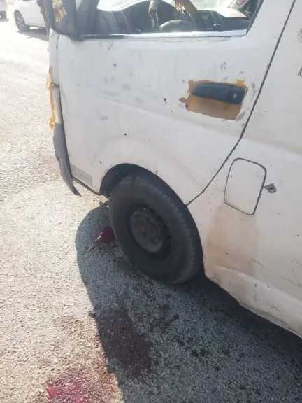 جريمة الشحر: إطلاق نار يعقب خلافاً بين مسلح وسائق.. والمصاب ينقل للمستشفى.