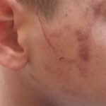 داخل مدرسة دار السلام بسوهاج.. معلمة تضرب تلميذًا بخرطوم الأنبوبة والتعليم تفتح تحقيقًا عاجلًا