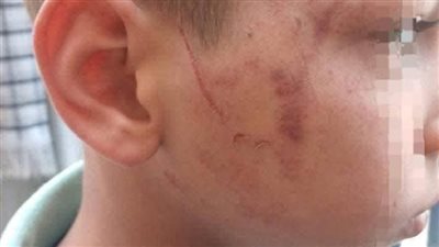 داخل مدرسة دار السلام بسوهاج.. معلمة تضرب تلميذًا بخرطوم الأنبوبة والتعليم تفتح تحقيقًا عاجلًا