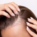 دواء فموي مبتكر يعزز نمو الشعر بنتائج واعدة خلال 6 أشهر