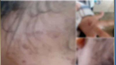 شخص يتهم طليقته ووالدتها بتعذيب نجلهما في الشرقية.. والداخلية تكشف الحقيقة