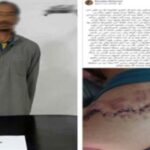 ضبط سائق ميكروباص بعد تعديه على راكب بـ«كتر» وإصابته قي الذراع بمنطقة غمرة