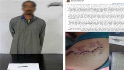 ضبط سائق ميكروباص بعد تعديه على راكب بـ«كتر» وإصابته قي الذراع بمنطقة غمرة