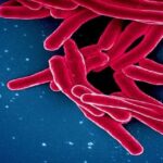 طبيبة توضح المدة التي يعيش فيها مسبب مرض السل في البيئة.. التفاصيل