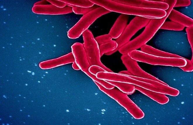 طبيبة توضح المدة التي يعيش فيها مسبب مرض السل في البيئة.. التفاصيل