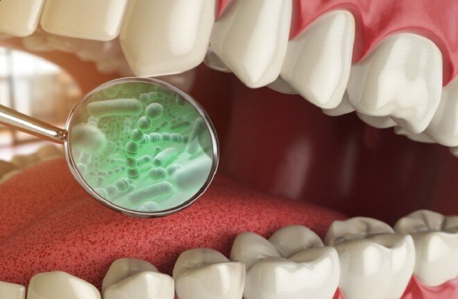 علكة حيوية تقضي على ميكروبات الفم المرتبطة بسرطان الرأس والرقبة