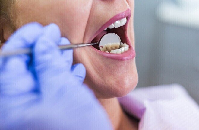 نزيف اللثة قد يهدد القلب.. تحذيرات طبية من مخاطر التهابات الفم المزمنة