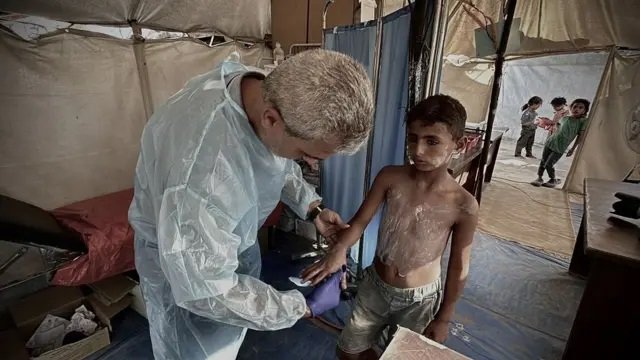 “الأونروا” تحذر من تدهور الأوضاع الصحية في غزة بسبب ارتفاع الإصابات بالالتهابات الجلدية- نبض مصر