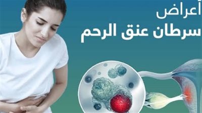 “انجاز طبي وشيك ”.. هل أقتربت نهاية سرطان عنق الرحم ؟- نبض مصر