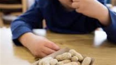 «دراسة سويدية :تكشف كيف يتم علاج حساسية الأطفال وسر الفول السوداني؟- نبض مصر