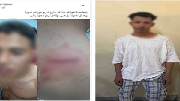 كشف ملابسات التعدي على شخص بالعجوزة.. والداخلية تضبط المتهم- نبض مصر