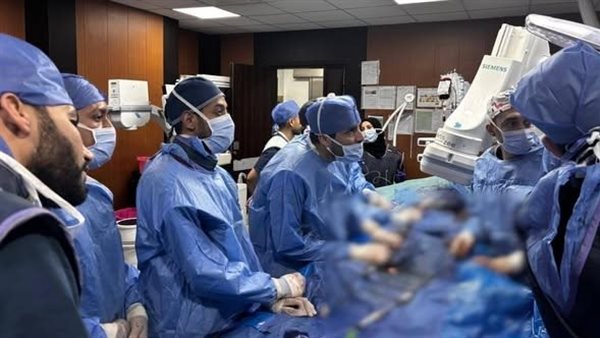 نجاح إجراء واحدة من أعقد عمليات القسطرة التداخلية لإصلاح تمدد الشريان الأورطي البطني والشرايين الحرقفية- نبض مصر